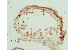 Immunohistochemistry of paraffin-embedded human testis tissue using ABIN7162541 at dilution of 1:100 (ZDHHC17 Antikörper  (AA 170-310))