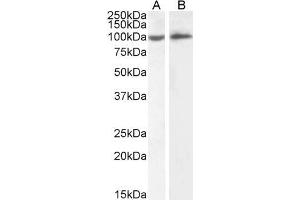 ABIN5539625 (2µg/ml) staining of HeLa (A) and Daudi (B) cell lysate (35µg protein in RIPA buffer). (ICAM1 Antikörper  (Internal Region))