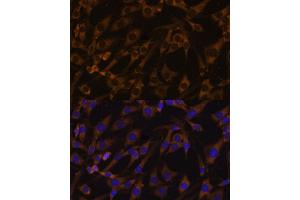 Immunofluorescence analysis of C6 cells using EIF5B antibody (ABIN7267052) at dilution of 1:100. (EIF5B Antikörper  (AA 1-273))