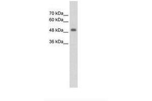 Image no. 1 for anti-CUE Domain Containing 1 (CUEDC1) (AA 251-300) antibody (ABIN203464) (CUEDC1 Antikörper  (AA 251-300))