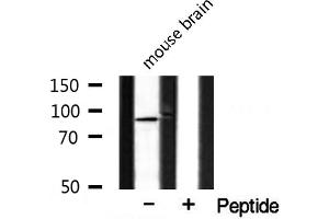 Western blot analysis of extracts from mouse brain, using CAGE1 antibody. (CAGE1 Antikörper  (C-Term))