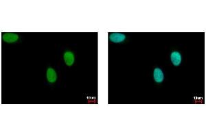 ICC/IF Image FANCJ antibody [N1N2], N-term detects BRIP1 protein at cytoplasm by immunofluorescent analysis. (BRIP1 Antikörper  (N-Term))