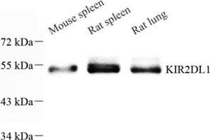 Western blot analysis of KIR2DL1 (ABIN7074433) at dilution of 1: 1600