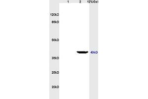 Lane 1: rat heart lysates Lane 2: rat brain lysates probed with Anti LTB4-R2 Polyclonal Antibody, Unconjugated (ABIN748643) at 1:200 in 4 °C. (LTB4R2 Antikörper  (AA 25-120))