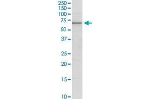 GAD2 MaxPab rabbit polyclonal antibody. (GAD65 Antikörper  (AA 1-585))