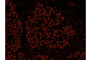 Immunofluorescence (IF) image for anti-Histone Deacetylase 2 (HDAC2) (C-Term) antibody (ABIN7448973)