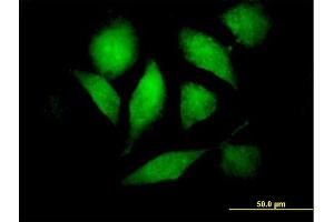 Immunofluorescence of purified MaxPab antibody to RAF1 on HeLa cell.
