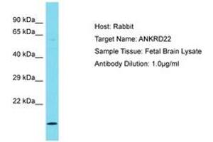 Image no. 1 for anti-Ankyrin Repeat Domain 22 (ANKRD22) (AA 48-97) antibody (ABIN6750744) (ANKRD22 Antikörper  (AA 48-97))