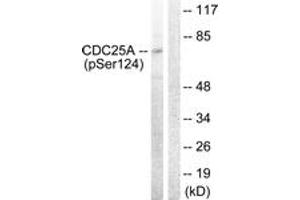 Western blot analysis of extracts from 293 cells treated with UV 15', using CDC25A (Phospho-Ser124) Antibody. (CDC25A Antikörper  (pSer124))