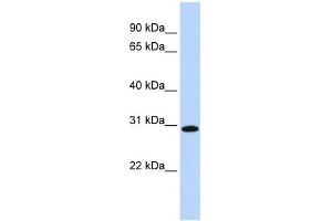 SMNDC1 antibody used at 1 ug/ml to detect target protein. (SMNDC1 Antikörper  (Middle Region))