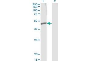 Western Blotting (WB) image for anti-serpin Peptidase Inhibitor, Clade B (Ovalbumin), Member 1 (SERPINB1) (AA 1-379) antibody (ABIN515234)