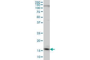 C1D monoclonal antibody (M03A), clone 6H2 Western Blot analysis of C1D expression in HeLa . (C1D Antikörper  (AA 1-141))