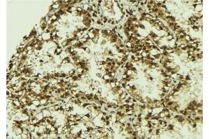 ABIN6279800 at 1/100 staining Human lung tissue by IHC-P.