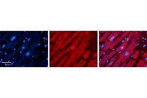 Rabbit Anti-TSG101 Antibody   Formalin Fixed Paraffin Embedded Tissue: Human heart Tissue Observed Staining: Cytoplasmic, nucleus Primary Antibody Concentration: 1:100 Other Working Concentrations: N/A Secondary Antibody: Donkey anti-Rabbit-Cy3 Secondary Antibody Concentration: 1:200 Magnification: 20X Exposure Time: 0. (TSG101 Antikörper  (N-Term))