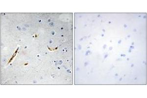 Immunohistochemistry (IHC) image for anti-Transcription Factor 3 (E2A Immunoglobulin Enhancer Binding Factors E12/E47) (TCF3) (AA 571-620) antibody (ABIN2889399) (TCF3 Antikörper  (AA 571-620))