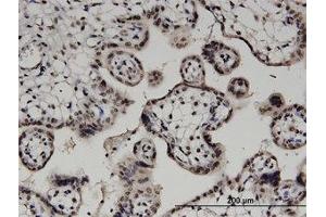 Image no. 1 for anti-Diacylglycerol Kinase, alpha 80kDa (DGKA) (AA 1-736) antibody (ABIN599366) (DGKA Antikörper  (AA 1-736))
