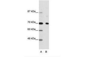 Image no. 1 for anti-Nuclear Receptor Co-Repressor 2 (NCOR2) (AA 541-590) antibody (ABIN202991) (NCOR2 Antikörper  (AA 541-590))