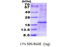 RPL35 Protein (AA 1-123) (His tag)