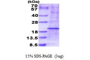 SDS-PAGE (SDS) image for Ribosomal Protein L35 (RPL35) (AA 1-123) protein (His tag) (ABIN5777754)
