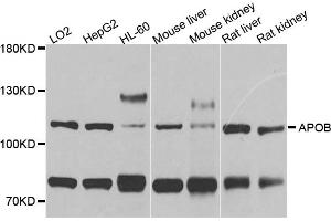 Western blot analysis of extracts of various cell lines, using APOB antibody (ABIN5970625) at 1/1000 dilution. (APOB Antikörper)