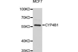 Western blot analysis of extracts of MCF-7 cells, using CYP4B1 antibody. (CYP4B1 Antikörper)