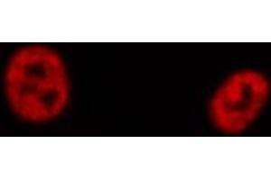 ABIN6274193 staining Hela cells by IF/ICC. (TFE3 Antikörper  (Internal Region))