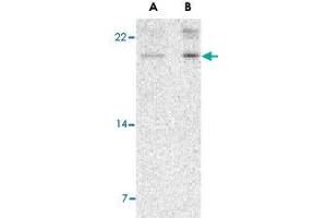 Western blot analysis of AES in 293 cell lysate with AES polyclonal antibody  at (A) 2 and (B) 4 ug/mL . (AES Antikörper  (N-Term))