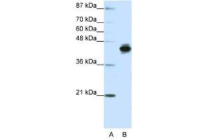 Cytokeratin 18 antibody used at 1. (Cytokeratin 18 Antikörper  (N-Term))