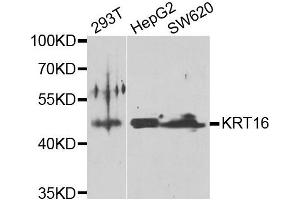 Western blot analysis of extracts of various cell lines, using KRT16 antibody. (KRT16 Antikörper)