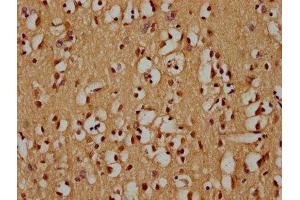 IHC image of ABIN7176072 diluted at 1:300 and staining in paraffin-embedded human brain tissue performed on a Leica BondTM system.