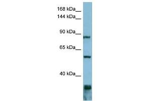WB Suggested Anti-EPS8 Antibody Titration: 0. (EPS8 Antikörper  (Middle Region))