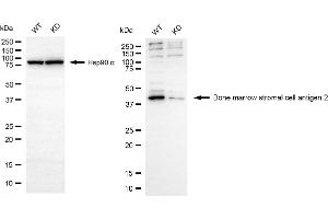 Western blotting analysis using bone marrow stromal cell antigen 2 antibody (ABIN7797773).
