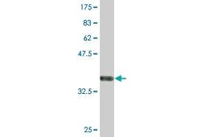 Western Blot detection against Immunogen (36. (POLR3B Antikörper  (AA 2-100))