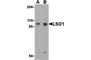 Western Blotting (WB) image for anti-Lysine (K)-Specific Demethylase 1A (KDM1A) (Middle Region) antibody (ABIN1030990) (LSD1 Antikörper  (Middle Region))