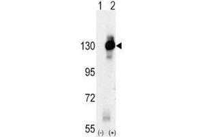 Western blot analysis of CSF1R antibody and 293 cell lysate (2 ug/lane) either nontransfected (Lane 1) or transiently transfected with the CSF1R gene (2). (CSF1R Antikörper  (AA 940-971))