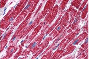 Immunohistochemistry (IHC) image for anti-Fumarate Hydratase (FH) (Internal Region) antibody (ABIN190758)
