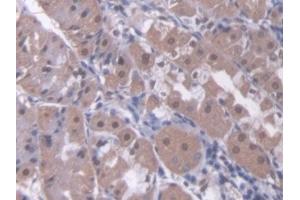 Immunohistochemistry (IHC) image for anti-Retinoic Acid Receptor, beta (RARB) (AA 205-451) antibody (ABIN7441115)