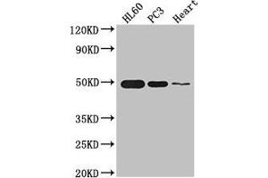 Western Blot Positive WB detected in: HL60 whole cell lysate, PC-3 whole cell lysate, Mouse heart tissue All lanes: ZNF2 antibody at 2.