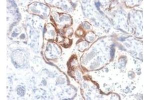 Formalin-fixed, paraffin-embedded human placenta stained with hCG beta Rabbit Recombinant Monoclonal Antibody (HCGb/1985R).