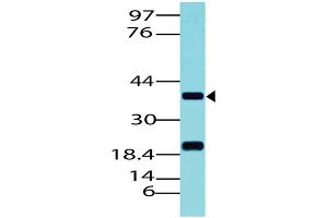 Image no. 1 for anti-Paired Box 5 (PAX5) (AA 102-339) antibody (ABIN5027430) (PAX5 Antikörper  (AA 102-339))