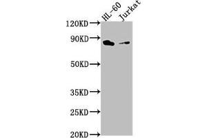 Western Blot Positive WB detected in: HL-60 whole cell lysate, Jurkat whole cell lysate All lanes: ELMO1 antibody at 1:2000 Secondary Goat polyclonal to rabbit IgG at 1/50000 dilution Predicted band size: 84, 29, 50 kDa Observed band size: 84 kDa (ELMO1 Antikörper  (AA 520-727))