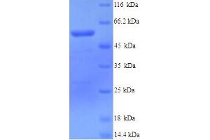 SDS-PAGE (SDS) image for Lysyl Oxidase-Like 1 (LOXL1) (AA 95-607) protein (His tag) (ABIN4976847) (LOXL1 Protein (AA 95-607) (His tag))