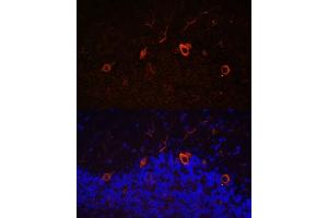Immunofluorescence analysis of mouse brain using K antibody (ABIN7268068) at dilution of 1:100. (KAL1 Antikörper  (AA 200-300))
