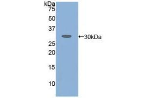 Western blot analysis of recombinant Human ATXN1. (Ataxin 1 Antikörper  (AA 569-807))