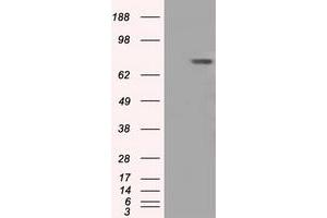 Western Blotting (WB) image for anti-Bruton Agammaglobulinemia tyrosine Kinase (BTK) antibody (ABIN1496975) (BTK Antikörper)