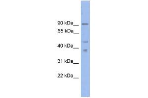 WB Suggested Anti-ZFX Antibody Titration:  0. (ZFX Antikörper  (N-Term))