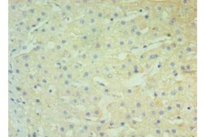 Immunohistochemistry of paraffin-embedded human liver tissue using ABIN7145678 at dilution of 1:100 (BST2 Antikörper  (AA 49-161))