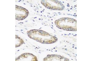 Immunohistochemistry of paraffin-embedded human gastric using NEDD4 antibody (ABIN5970204) at dilution of 1/200 (40x lens).