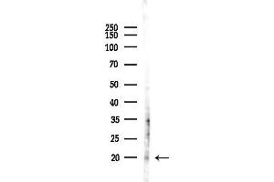 Western blot analysis of lysates from MDA-MB-231 cells(heat-shock,45 min treatment), using MRPL17 Antibody at 1/1000 dilution.