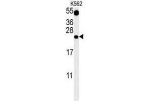 TFAM Antibody (C-term) western blot analysis in K562 cell line lysates (35 µg/lane). (TFAM Antikörper  (C-Term))